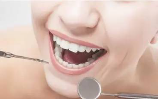 牙齿矫正不能吃什么;矫正牙齿不能吃什么东西(图1)
